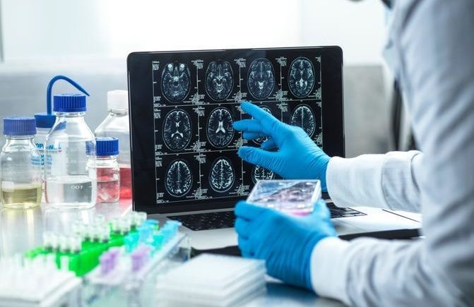 Un IRM puissant livre des images d'une précision inédite du cerveau de l'enfant