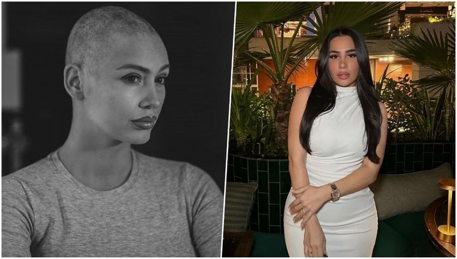 Eloise Appelle atteinte d'un cancer : le message de soutien de Milla Jasmine engendre une vive polémique