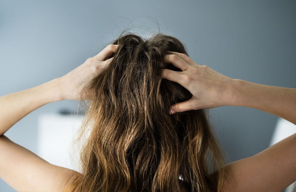 Psoriasis à la racine des cheveux : ces gestes surprenants du quotidien qui peuvent le déclencher