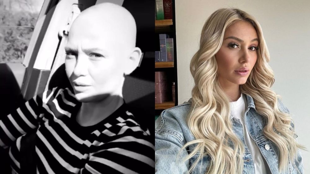 Eloïse Appelle : atteinte d'un cancer, elle explique pourquoi elle n'a plus le droit de se raser !