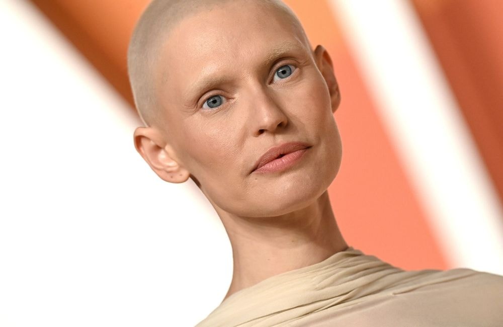 « Un diagnostic ne signifie pas la fin de la beauté » : exclue du défilé Victoria’s Secret, Bianca Balti se confie sans filtre