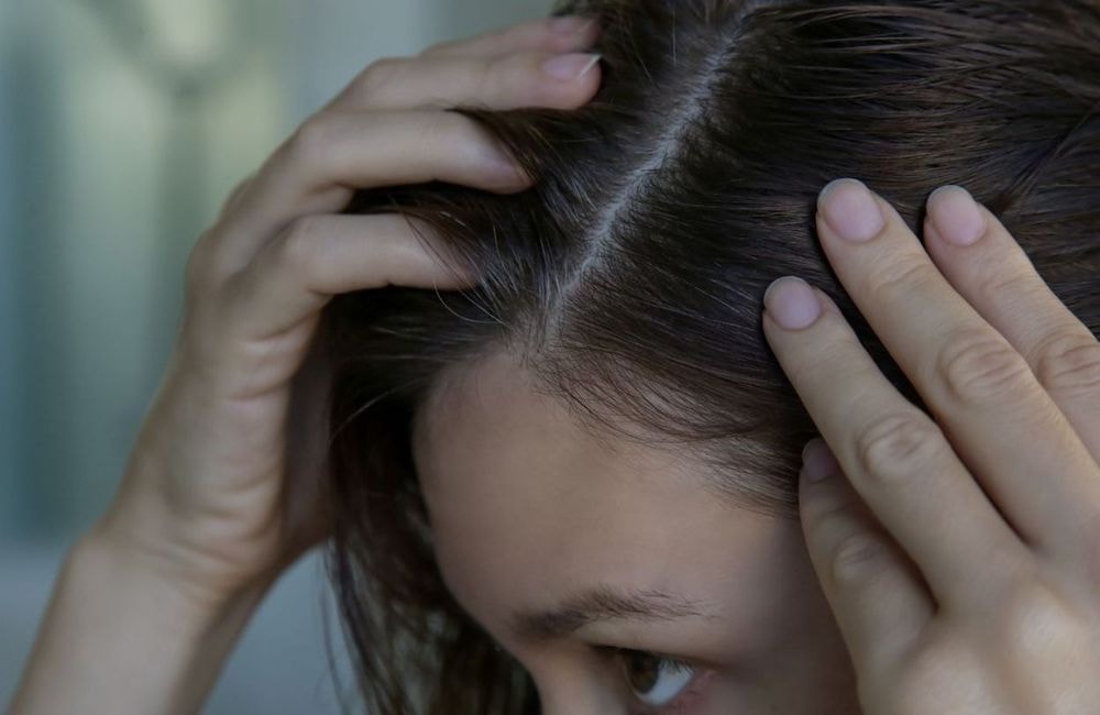 Pourquoi les 20-30 ans ont-ils des cheveux blancs de plus en plus tôt ?