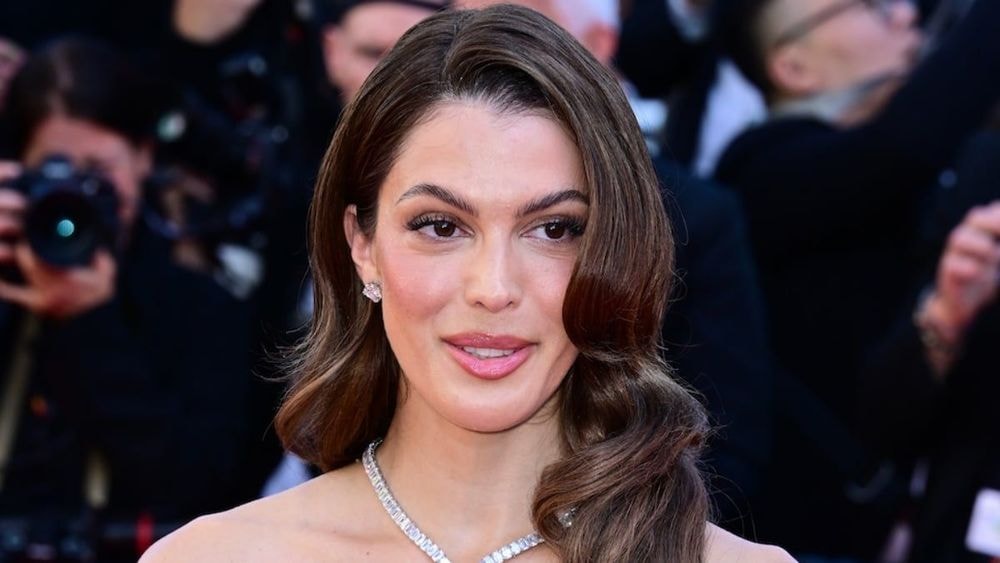 Iris Mittenaere (32 ans) le visage amoché : "Je décide de ne pas vous le cacher"