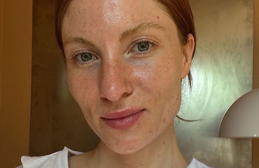 RealSkin : le mouvement body positive qui prend de l’ampleur sur les réseaux sociaux