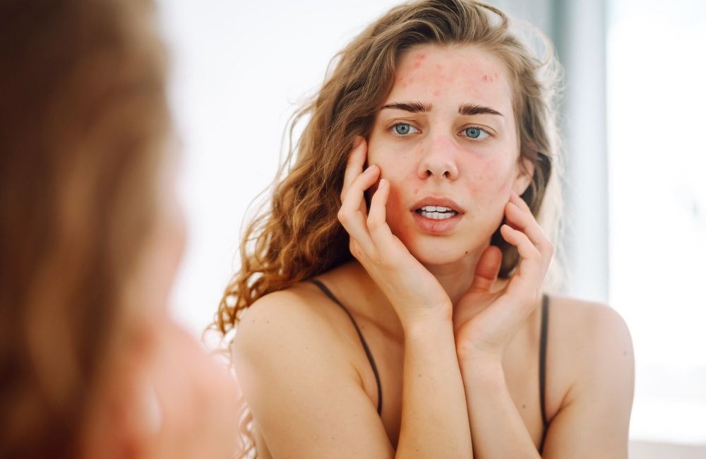 « La peau a une mémoire » : une biochimiste alerte sur l'excès d'acides et de rétinoïdes