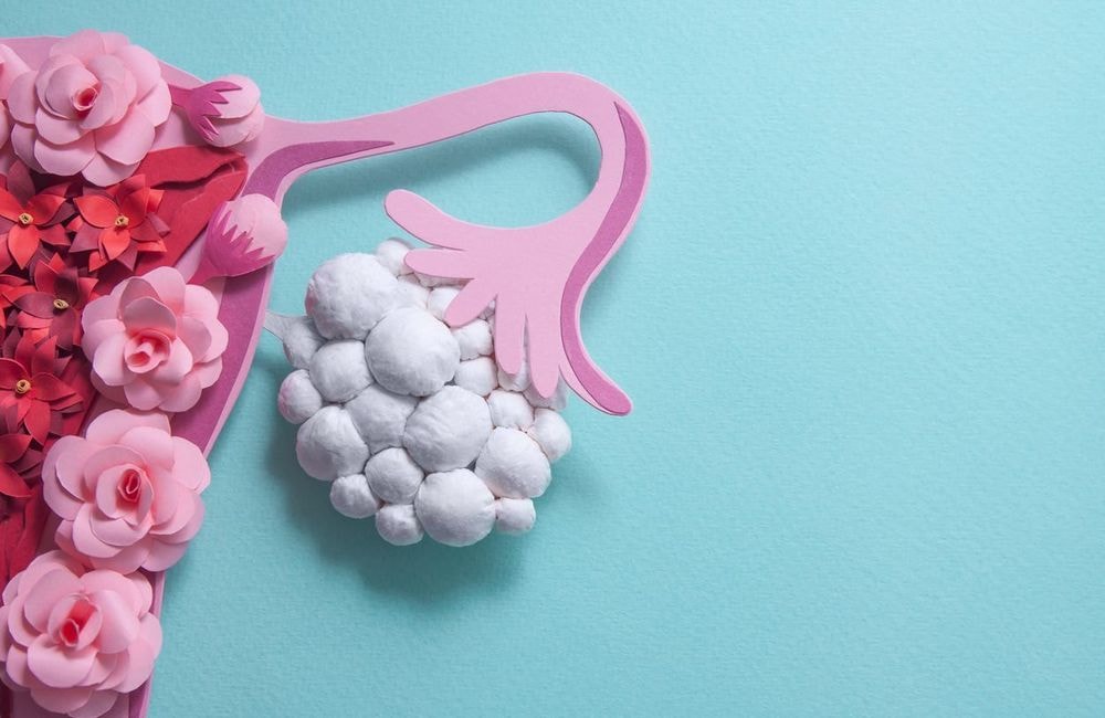 « SOPK » intègre le Larousse 2027 : retour sur ce syndrome, première cause d’infertilité féminine