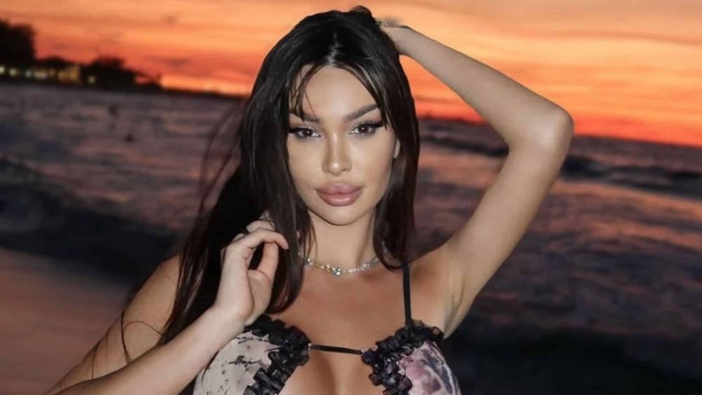 Sandra (Île de la tentation) : des photos chocs d'elle avant la chirurgie refont surface, regardez !