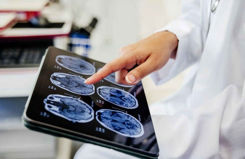 Le cerveau des psychopathe a une particularité, selon cette étude