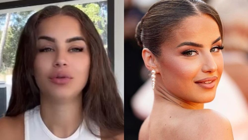 Kamila : après son IRM de la poitrine, elle fait des confidences peu rassurantes, "Il se peut qu’il y ait…"