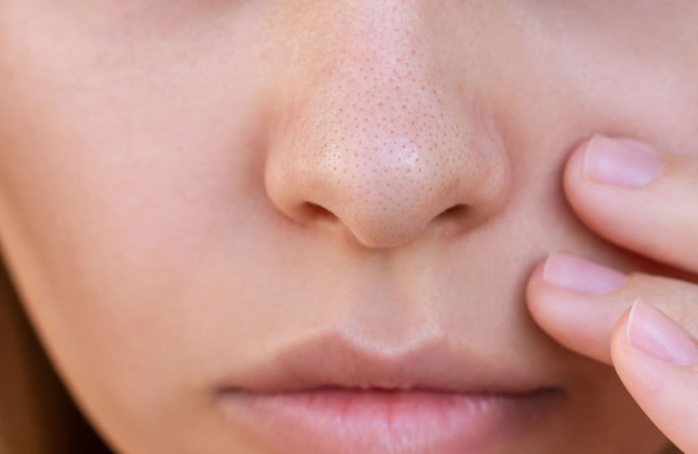 Qu'est-ce que les filaments sébacés, ces imperfections semblables aux points noirs (et comment en venir à bout) ?