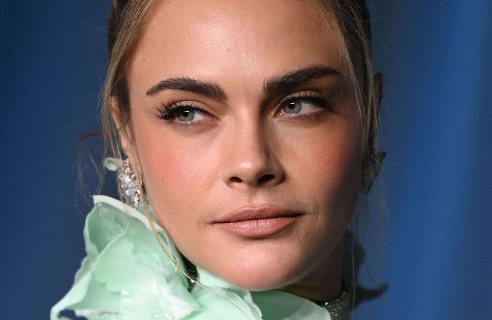 « Je n'avais pas de menton, c'était un complexe » : Cara Delevingne se confie sur ses injections d'acide hyaluronique