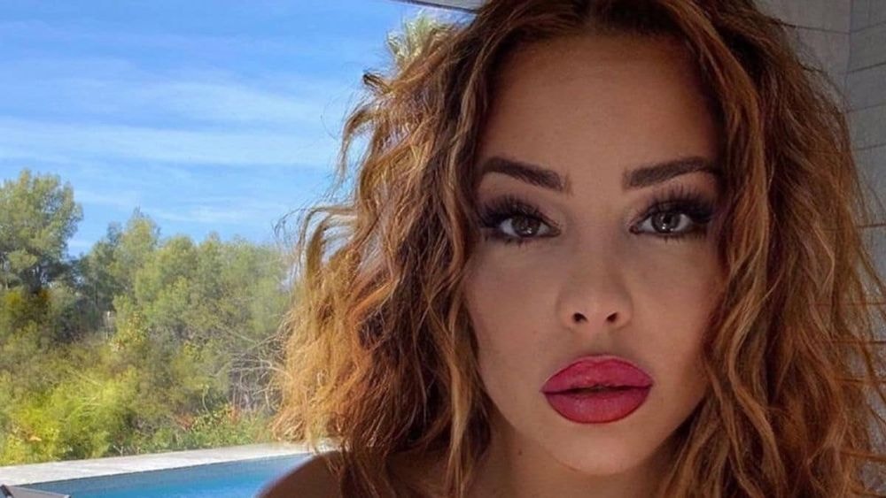 Kim Glow : après une chute, elle a peur de souffrir d’une hémorragie interne