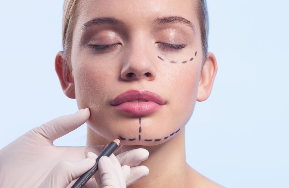Menton fuyant, profil déséquilibré… Pourquoi la technique du Chin Filler est-elle de plus en plus demandée en médecine esthétique ?