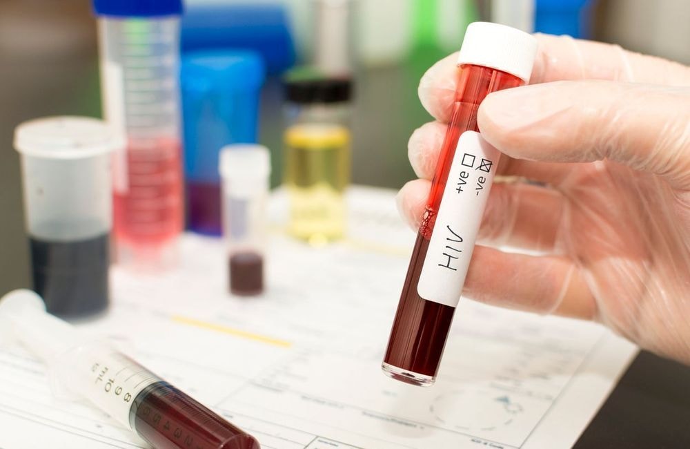 VIH : alerte sur une recrudescence des contaminations en Savoie