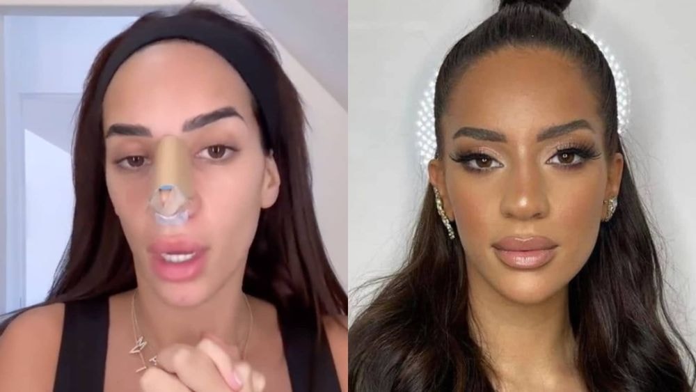 Raisons, tarif, convalescence : Marwa Merazka se confie sans filtre sur son opération du nez !
