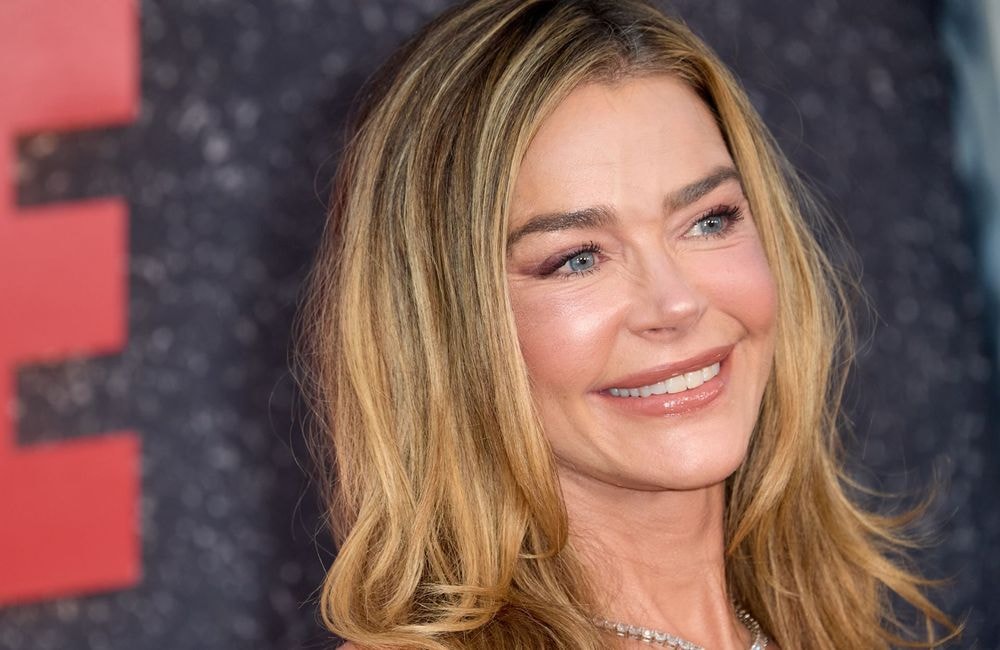 À 55 ans, Denise Richards révèle son lifting : les images spectaculaires de sa transformation affolent les réseaux