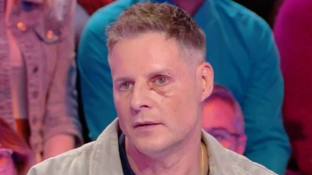 "Je me suis vraiment fait peur" : le visage tuméfié, Matthieu Delormeau raconte son terrible accident dans Tout beau tout 9 !