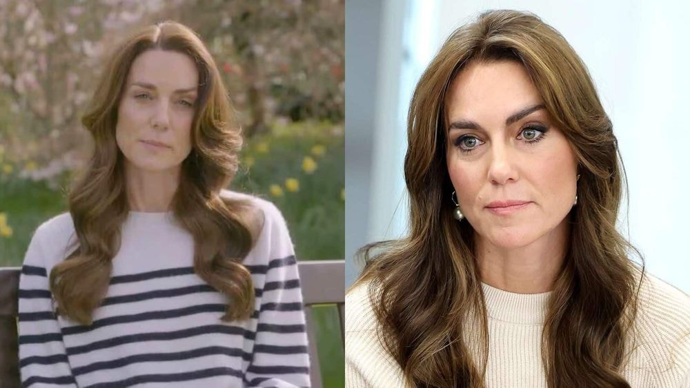 Kate Middleton souffrante : de quel cancer souffre la princesse de Galles ? Les détails sur son état de santé !