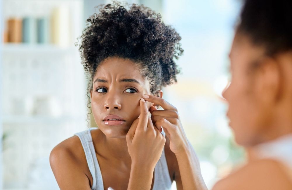 L’astuce express d’un dermatologue pour éradiquer un bouton d’acné