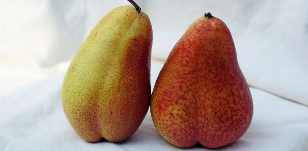Pourquoi a-t-on des poils entre les fesses?