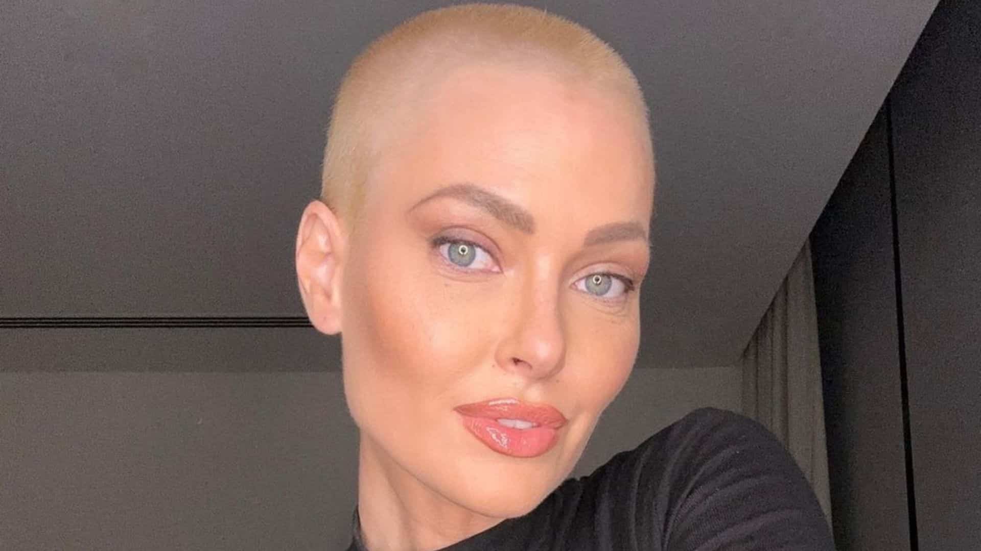 Caroline Receveur guérie du cancer mais toujours sous traitement : elle révèle ses douloureux effets secondaires !