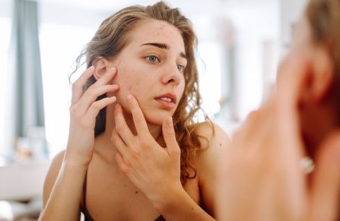Acné dans le dos : ce geste simple à faire sous la douche pour limiter les boutons