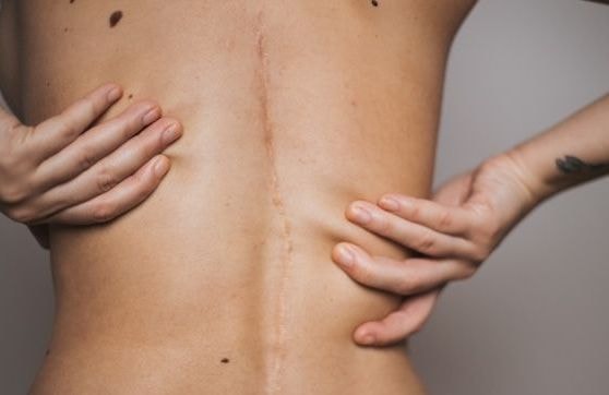 4 erreurs à ne pas reproduire quand on veut éviter les cicatrices visibles
