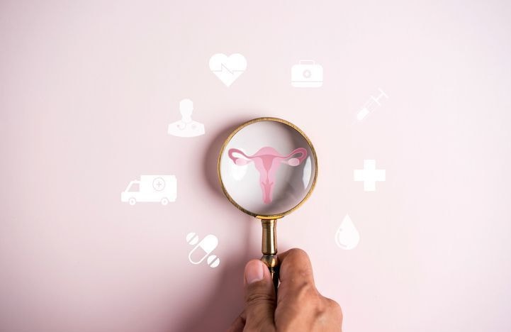 « Une avancée majeure pour la santé des femmes » : des chercheurs sur la piste d’un traitement contre le SOPK