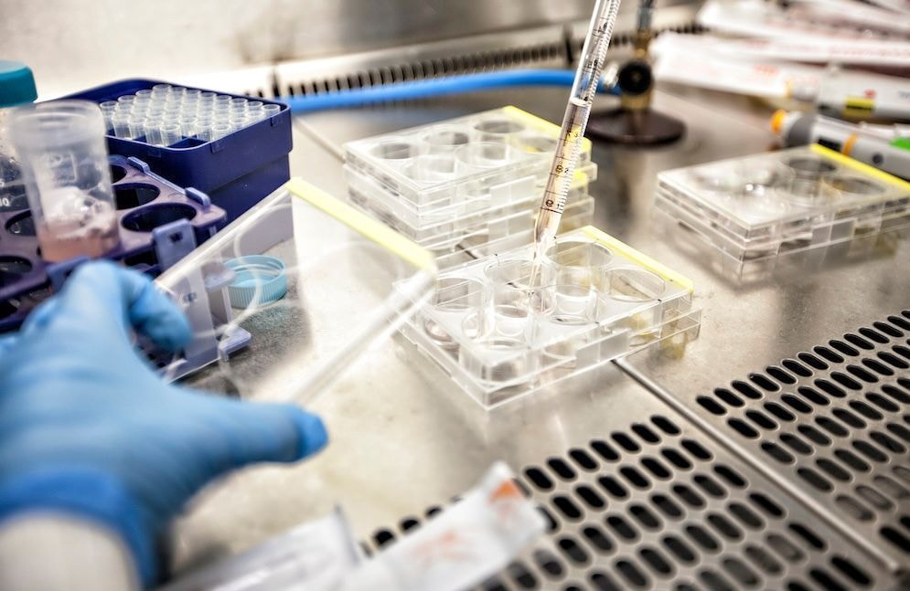 VIH: une patiente séropositive en rémission après une greffe, une première en France