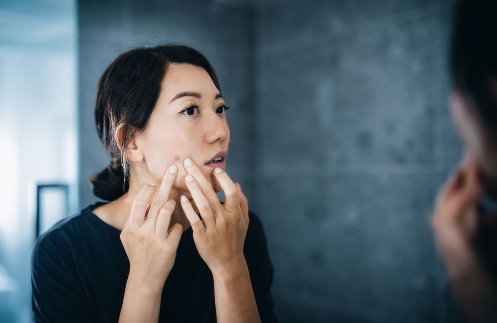 Poussée d'acné : cette technique de médecine traditionnelle chinoise calme rapidement les imperfections