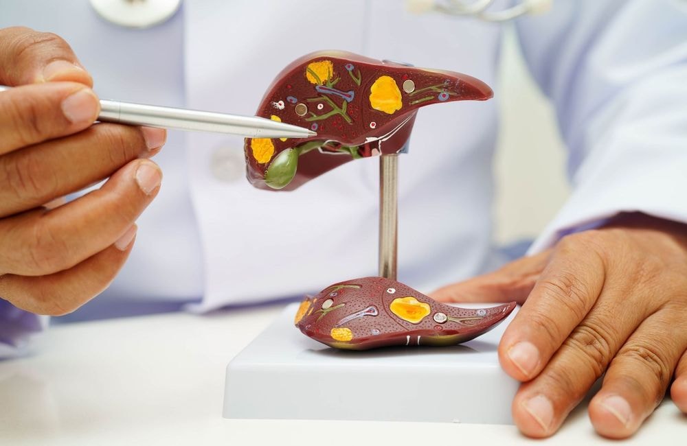 Ces facteurs qui pourraient permettre d'éviter 15 millions de cancers du foie