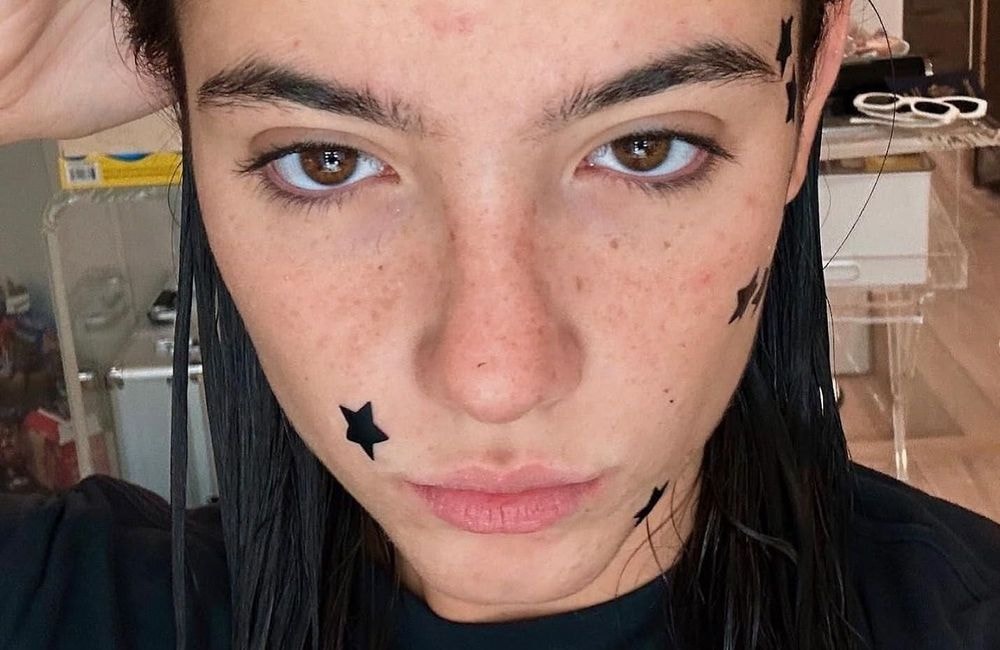 Comment les stars ont transformé le patch anti-boutons en accessoire hype