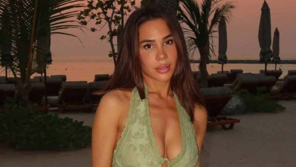 Milla Jasmine : le résultat de son importante chirurgie du visage dévoilée, regardez !