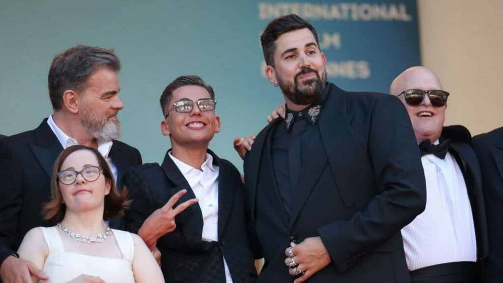 Artus : un acteur de son film Un p'tit truc en plus abandonné par ses parents à cause de son trouble