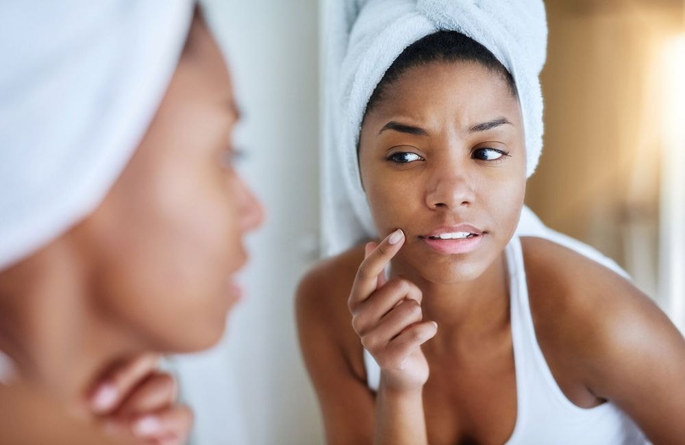 Acné : ce soin anti-imperfections cumule plus de 50 millions de vues sur les réseaux