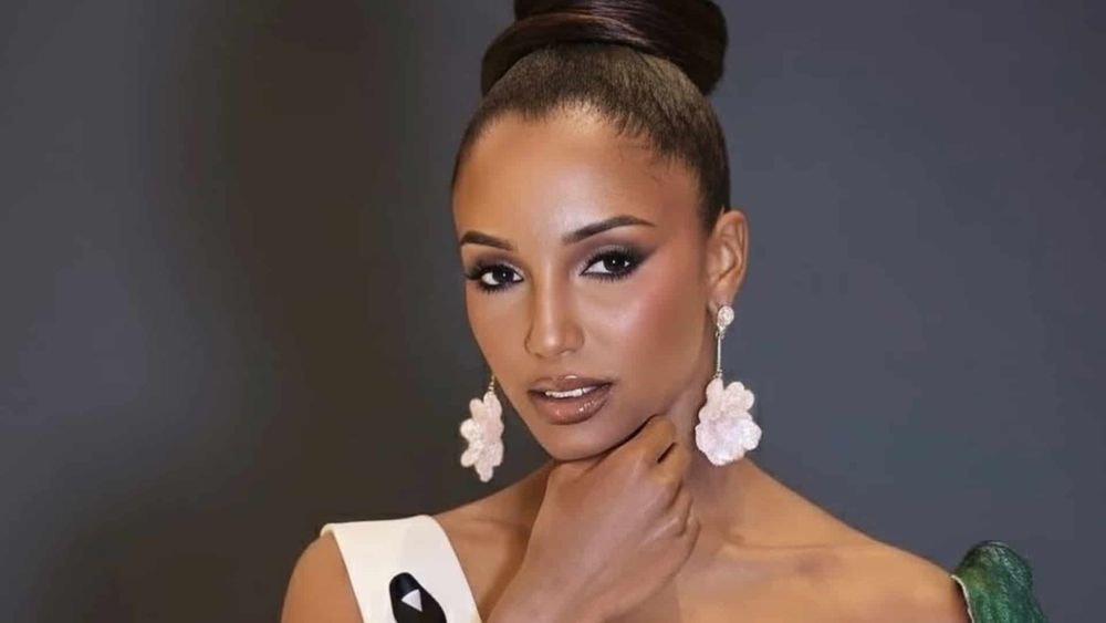 Fracture, hémoragie intracrânienne... : Miss Jamaïque toujours hospitalisée après sa violente chute à Miss Univers, les nouvelles ne sont pas bonnes !