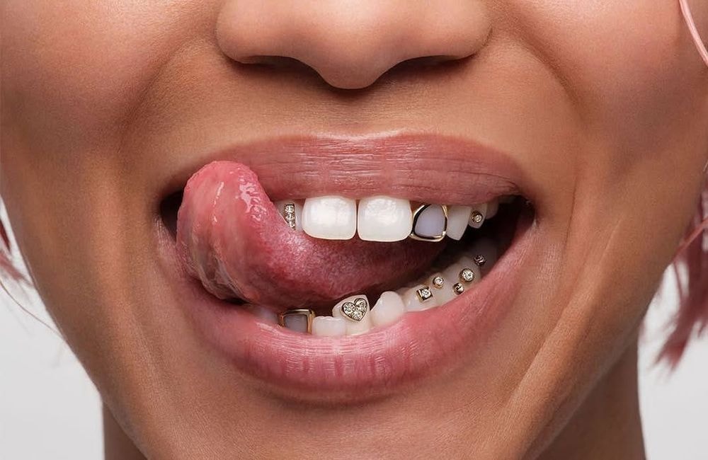 Les Grillz, ces bijoux du hiphop qui font briller de mille feux les sourires de la Gen Z