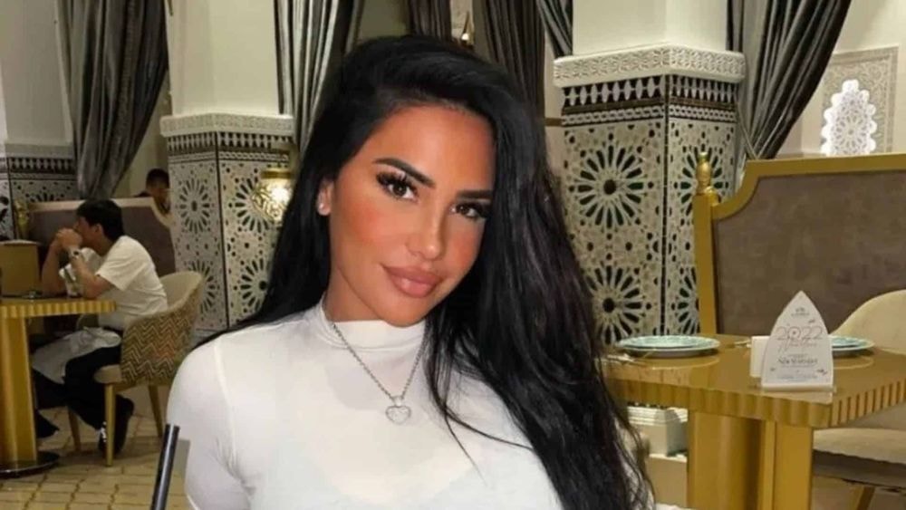 "Horrible" : Milla Jasmine refait des injections au visage, les internautes sous le choc !