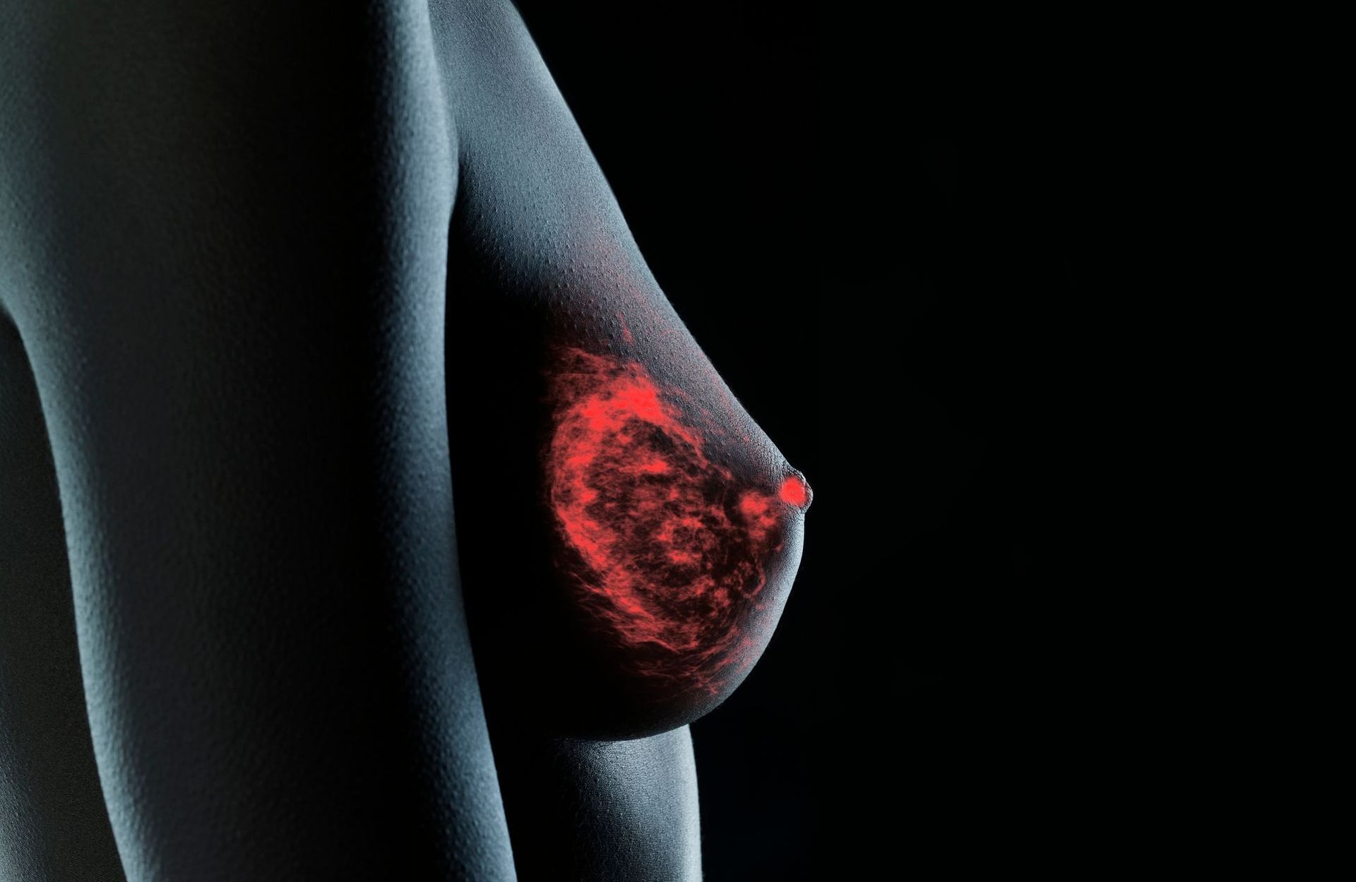 Cancer du sein : quels sont les premiers symptômes qui doivent vous inquiéter ?